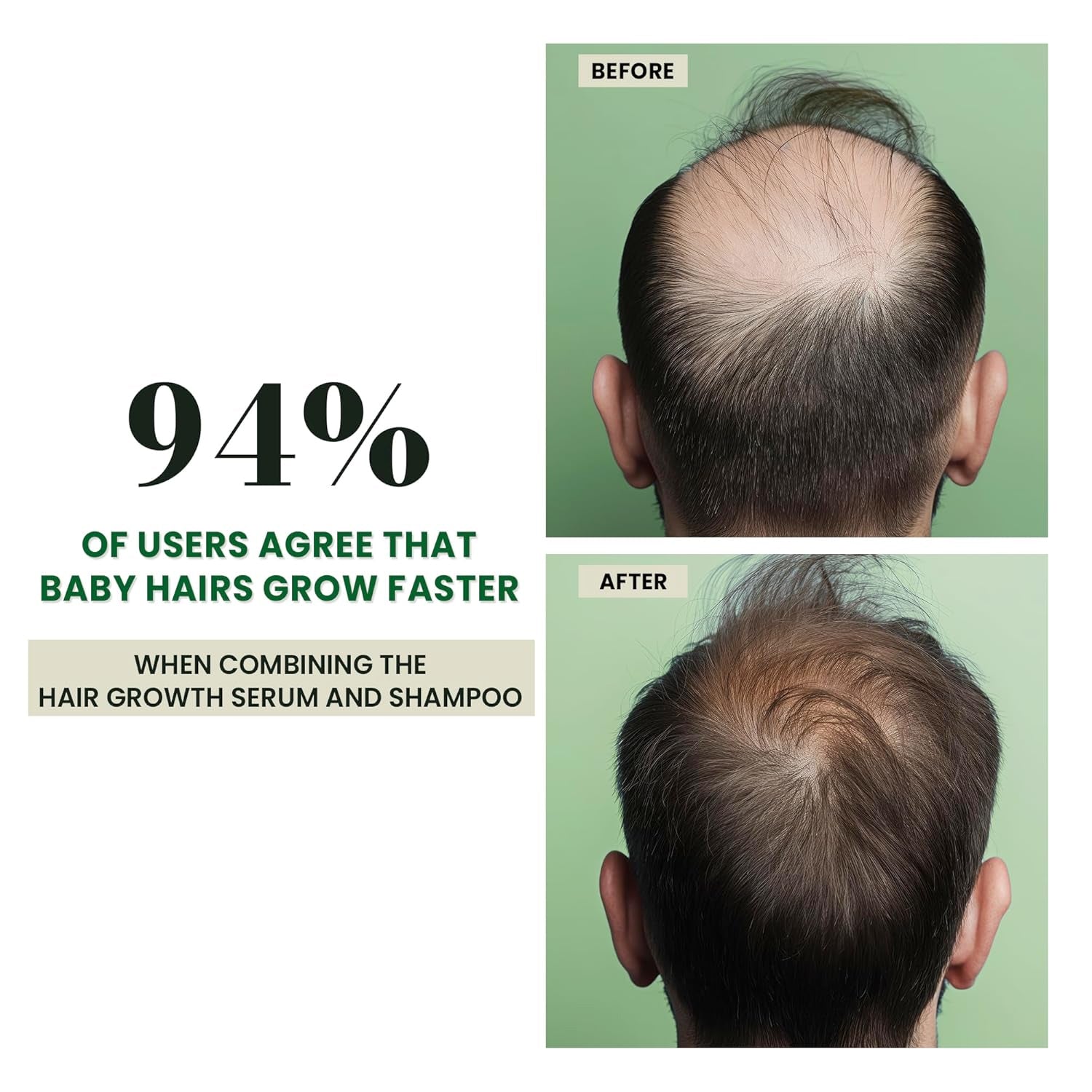New ABERA Hair Growth
