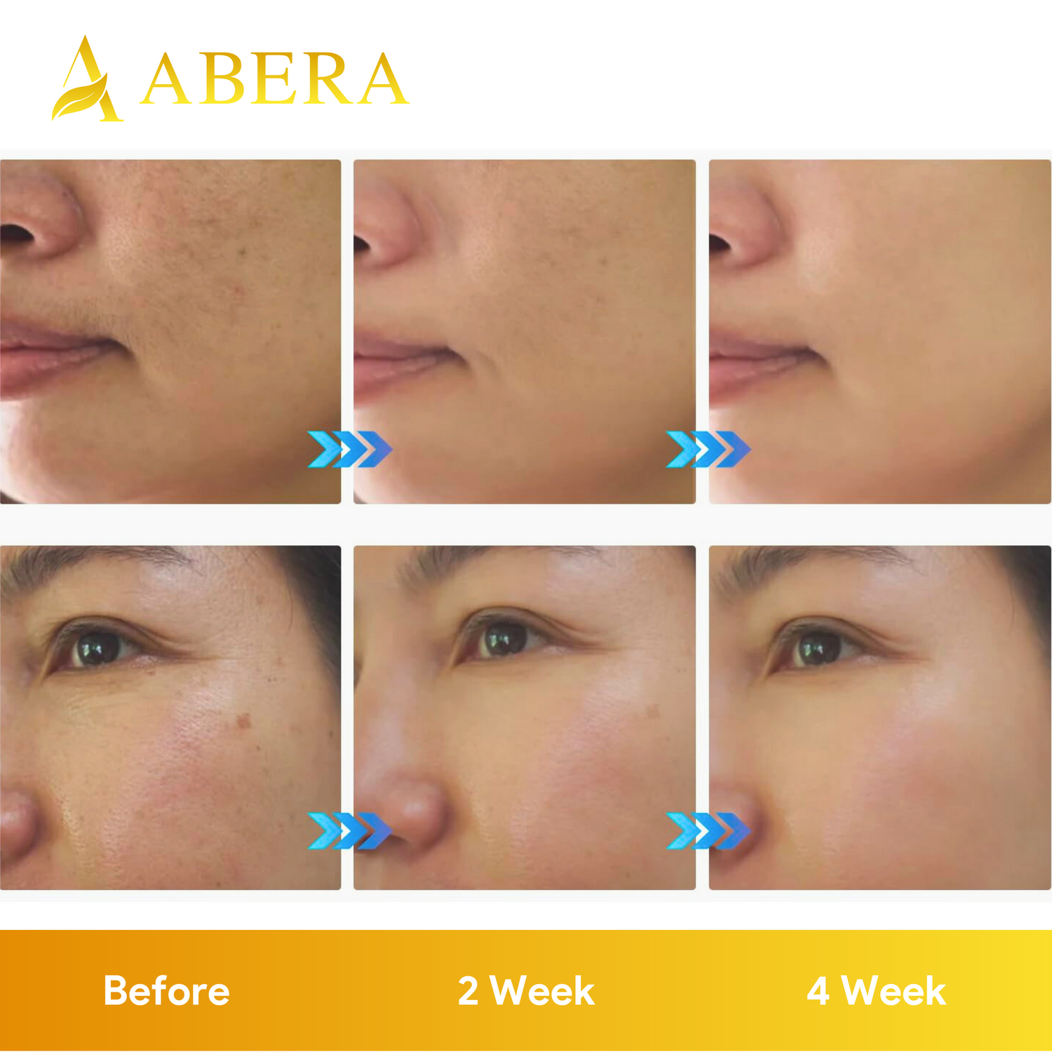 Abera Serum Melasma Treatment for Face - ABERA