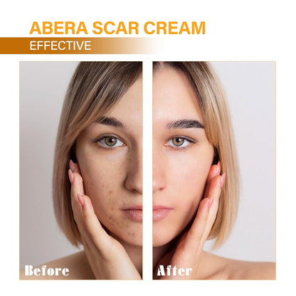 Abera Scar Red Turmeric Cream Limited