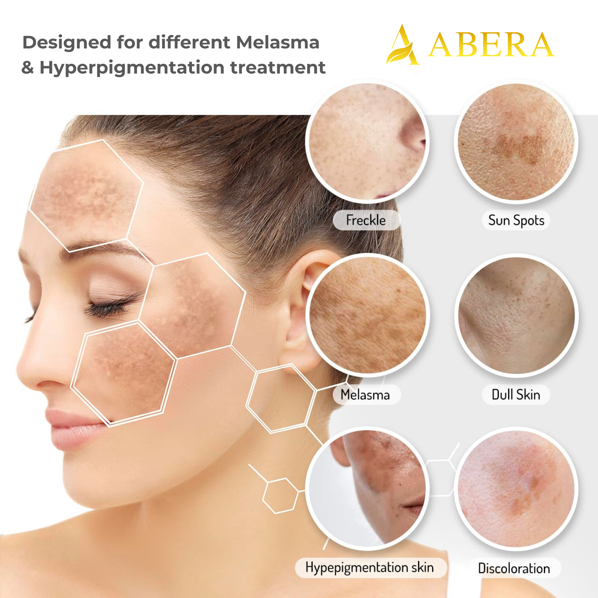 ABERA Melasma Serum, Dark Spot Corrector Serumwith Niacinamide and Hyaluronic Acid, Melasma Treatment for Face (AMZ)