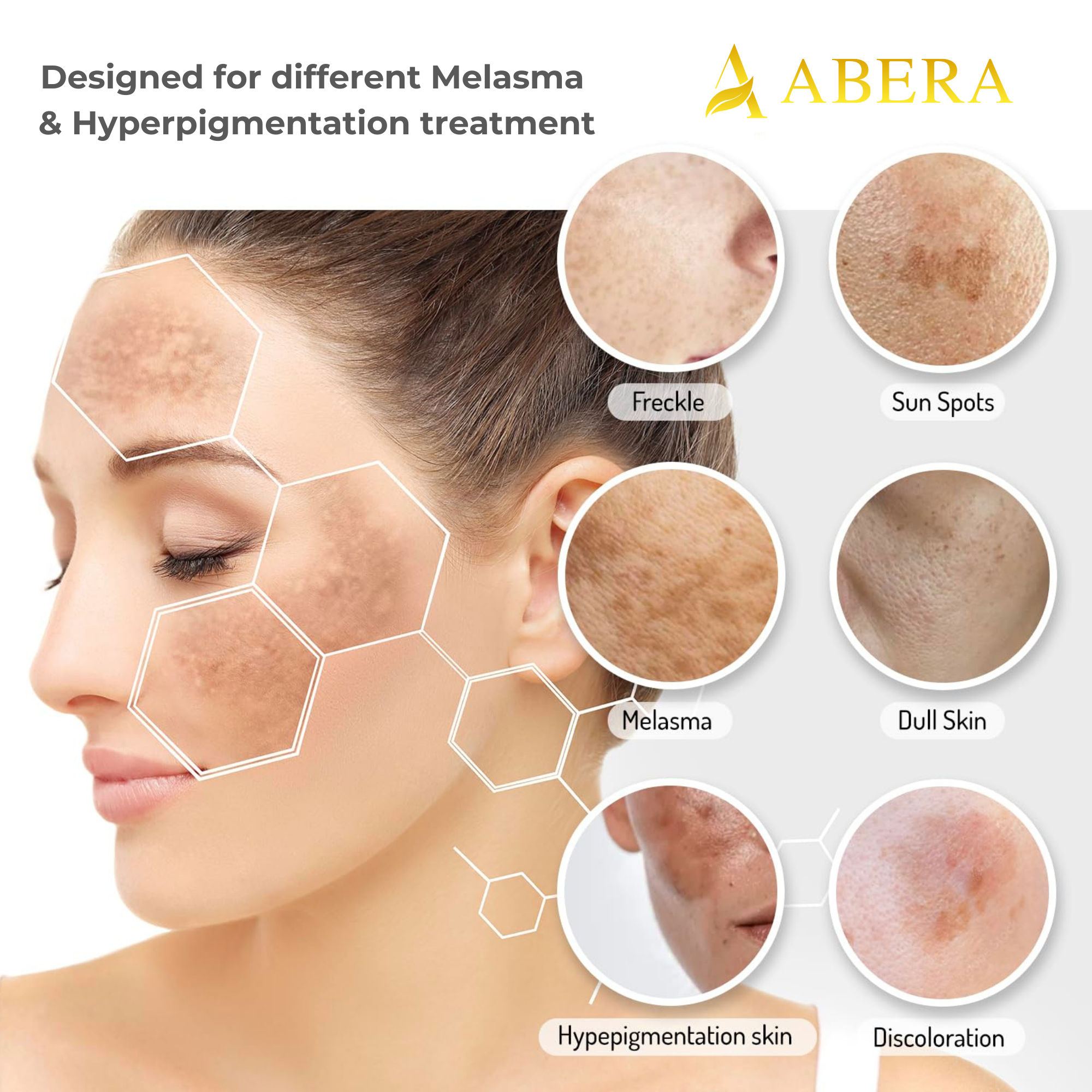 Abera Melasma Pigmentation Treatment for Face - CS