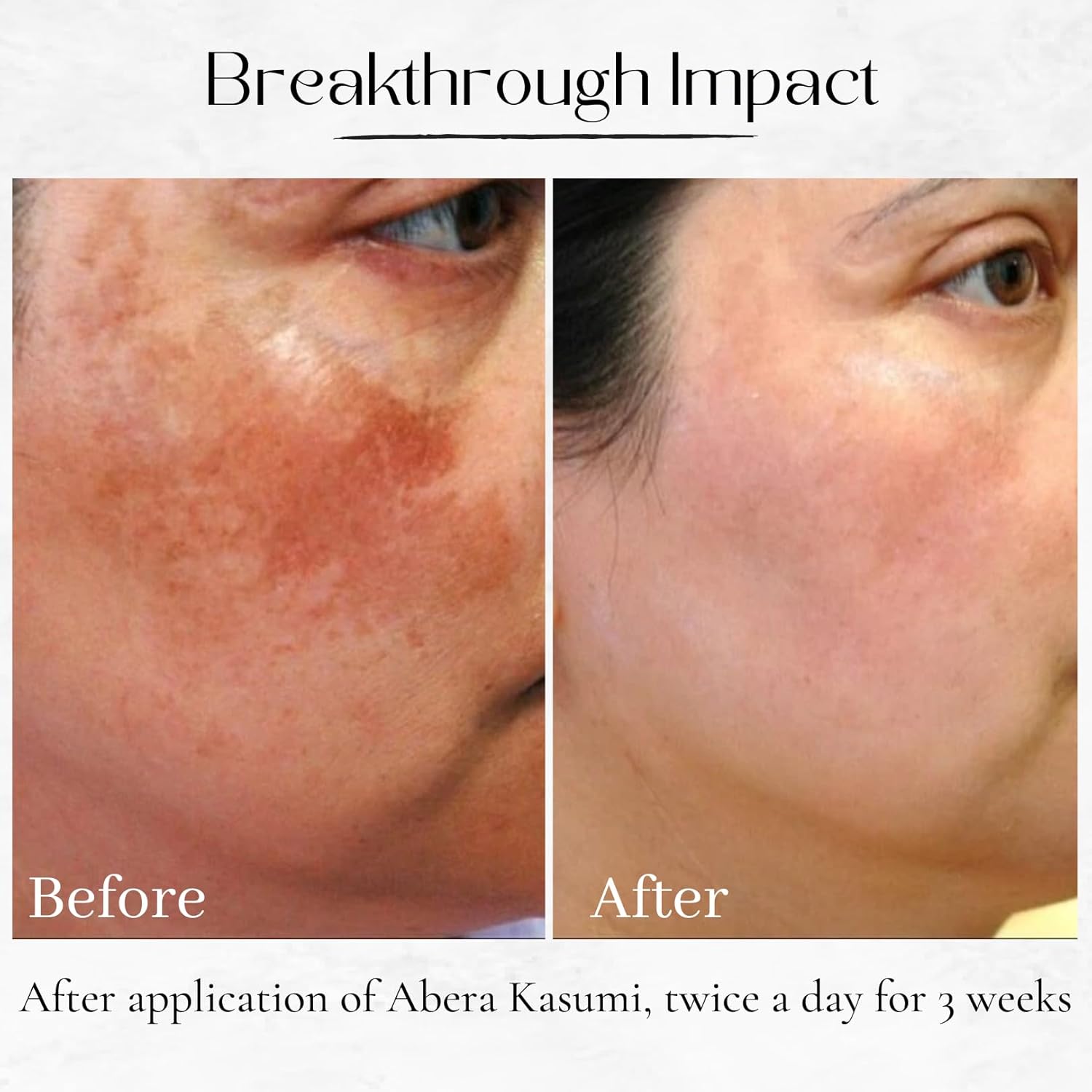 Kasumi Cream & Melasma Serum