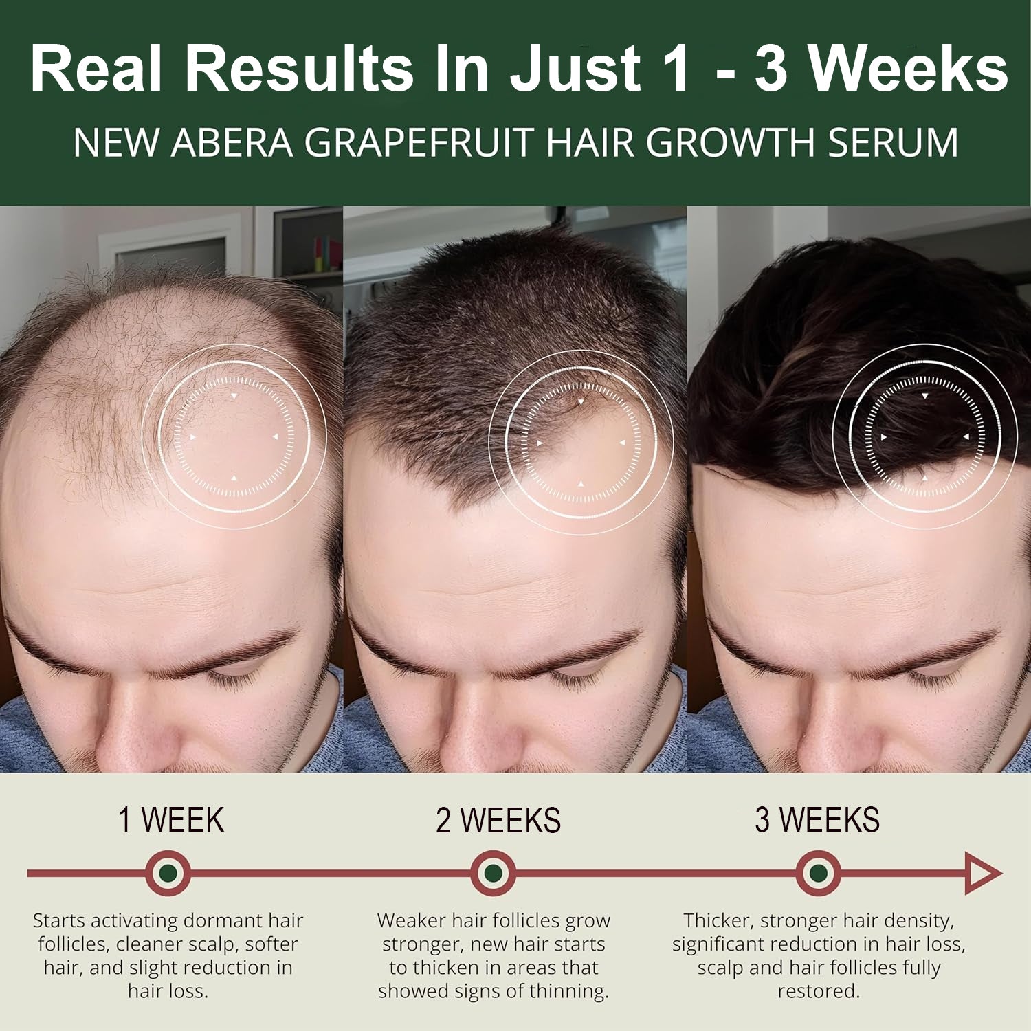 New ABERA Hair Growth