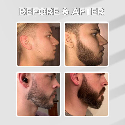 GINB PRO Beard Serum - Beard &amp; Eyebrows Growth Serum - 20ml Hair Care Evening