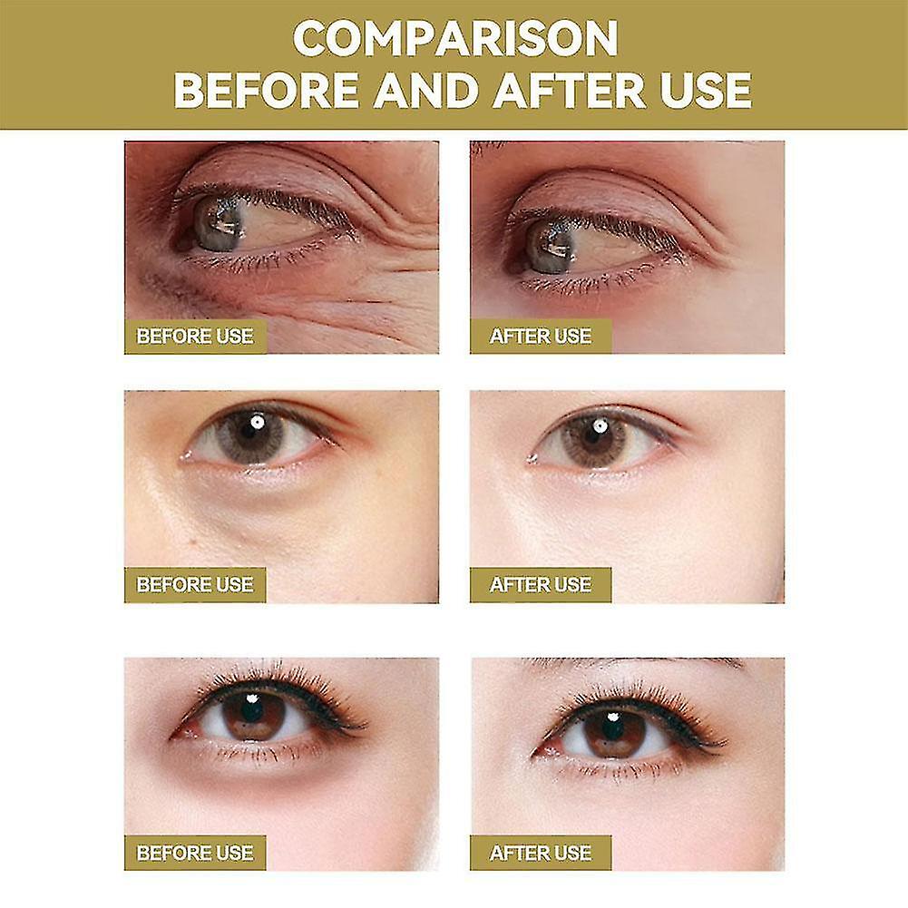 [SALE OFF 50%] Kasumi Abera Cream - GIFT Eye Patches